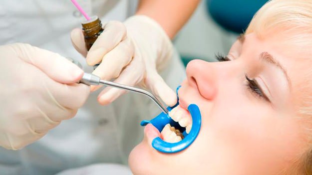 Lady having Dental sealants Treatment in Guildford, BC